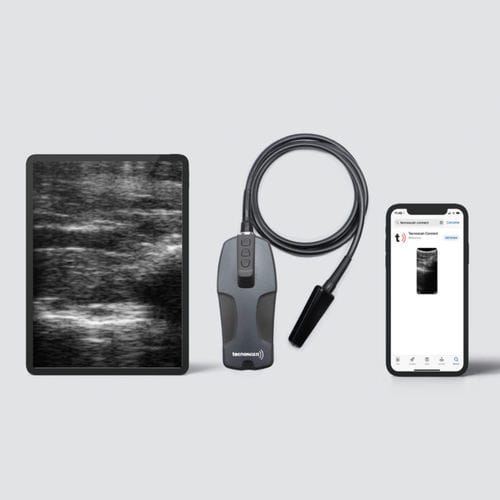 兽医超声波检查仪 / 便携式 - BL Tecnoscan - Tecnovet - 多功能 / 无线探头
