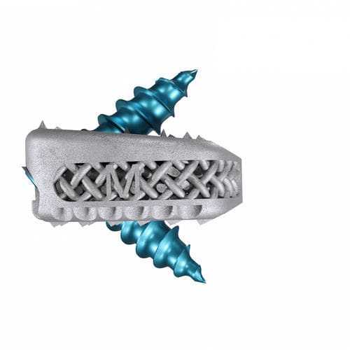 颈椎间融合器 - Magnolis® Z - Maxxspine Innovative - 前入路