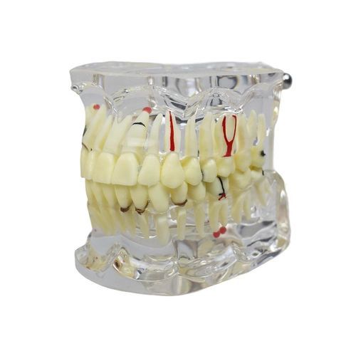 假牙解剖模型 - JG-Y15-IM - FOSHAN JINGLE MEDICAL EQUIPMENT CO., LTD - 根管 / 牙科 / 树脂