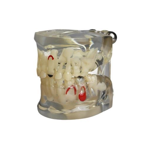 牙齿解剖模型 - JG-Y15-RJ - FOSHAN JINGLE MEDICAL EQUIPMENT CO., LTD - 假牙 / 培训 / 儿科