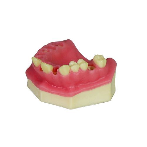 牙龈解剖模型 - JG-Y8-F3 - FOSHAN JINGLE MEDICAL EQUIPMENT CO., LTD - 骨 / 手术 / 培训