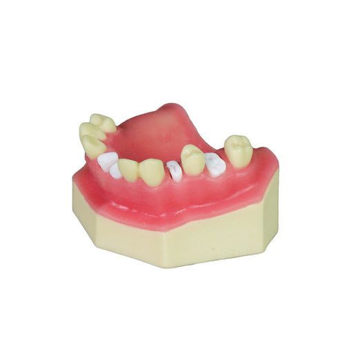 牙窦解剖模型 - JG-Y8-F5 - FOSHAN JINGLE MEDICAL EQUIPMENT CO., LTD - 牙科 / 牙龈 / 颌骨
