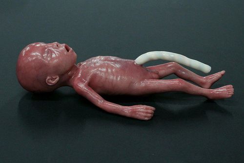 儿科护理医学教学模型 - MICRO-PREEMIE - LifeCast Body Simulation Ltd - 气胸 / 婴儿 / 硅胶
