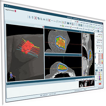 治疗计划制定软件 - SagiPlan® - BEBIG MEDICAL GmbH - 评估 / CT计算机断层扫描 / 核磁共振MRI