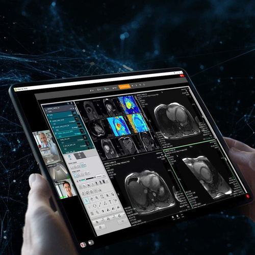 可视化通信管理系统 - uOmniscan - Shanghai United Imaging - DICOM文件 / PACS（医学影像系统） / 视频