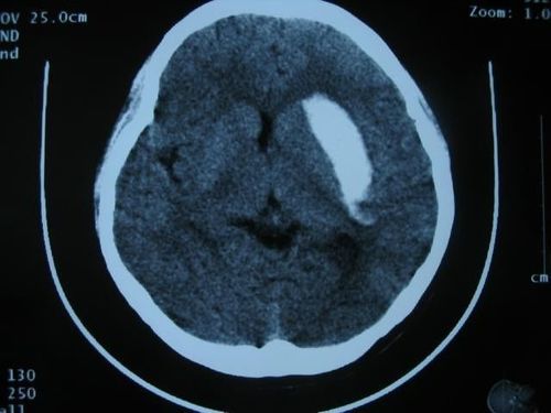 多功能放射照相X光胶片 - KND-A/KND-F - Shenzhen Kenid Medical Devices - 14 x 17