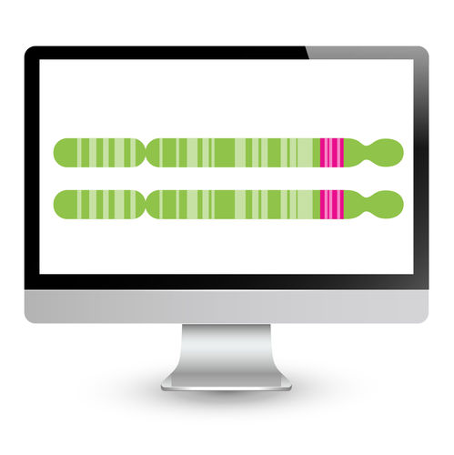 分子生物自动分析仪 / 用于FSHD诊断 - EnFocus™ - Bionano Genomics