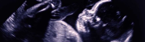 分析软件 - Congenica Prenatal™ - Congenica Ltd - 诊断 / 医用 / 临床