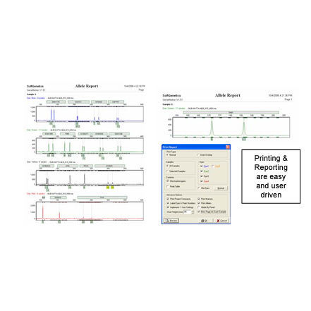 分析软件 - GeneMarker®HID  - SoftGenetics, LLC. - 医用 / 毛细管电泳