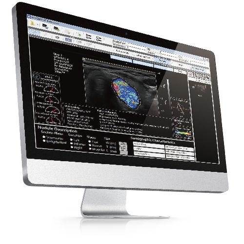 超声波成像软件 - AmCAD-UT® - AmCad BioMed - 图像分析 / 管理 / 报告
