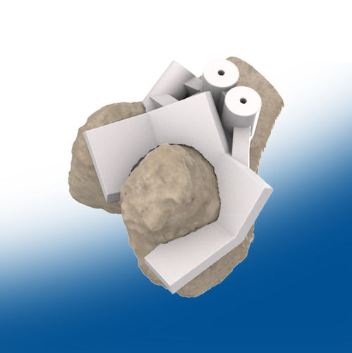 人工髋关节假体截骨导向器 - 3D - Ortho Baltic
