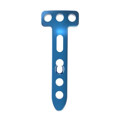 胫骨截骨术固定板 - TRUE LOCK Proximal Tibia High Osteotomy - Truemed Medical - 近端 / 锁定 / 金属