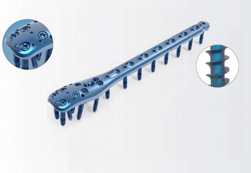 肱骨加压接骨板 - TRUE LOCK Proximal Humerus - Truemed Medical - 近端 / 锁定 / 金属