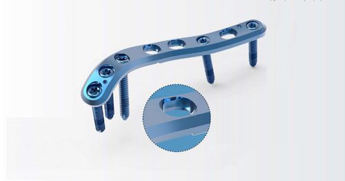 肱骨加压接骨板 - TRUE LOCK Proximal Humerus - Truemed Medical - 远侧 / 侧面 / 锁定