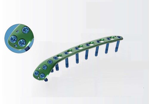 肱骨加压接骨板 - TRUE LOCK Distal Humerus Posterolateral - Truemed Medical - 远侧 / 后外侧 / 锁定