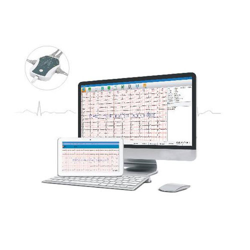 数据管理系统 - PCECG  - Rencare - ECG