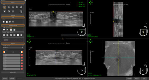 医学报告软件 - BR-Viewer™ - TaiHao Medical - 查看 / 诊断 / 乳腺癌筛查