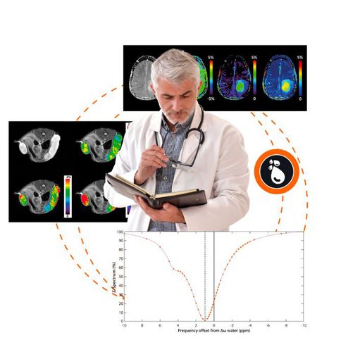 分析软件 - APT CEST MRI V.1.0 - Olea Medical - 后处理 / 染色体图谱绘制 / 医用