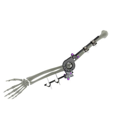 肘外固定架 - UniX® - WishBone Medical - 管状