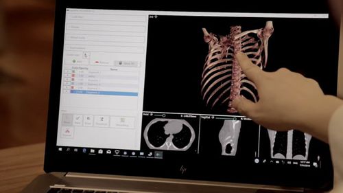 3D可视化软件 - DigiTwin - Medical Augmented Intelligence (MAI) - 诊断 / 共享 / 加工