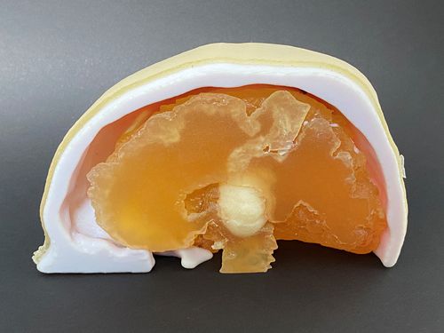 颅骨解剖模型 - Schiner3DRepro - 脑部 / 神经外科 / 培训