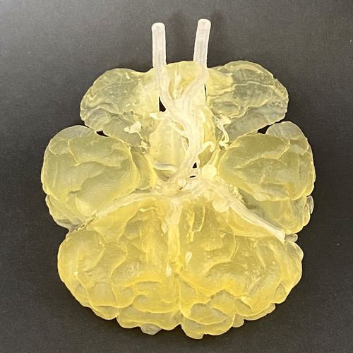 股骨动脉解剖模型 - Circulus Willisii - Schiner3DRepro - 威利环状动脉环 / 脑部 / 神经外科