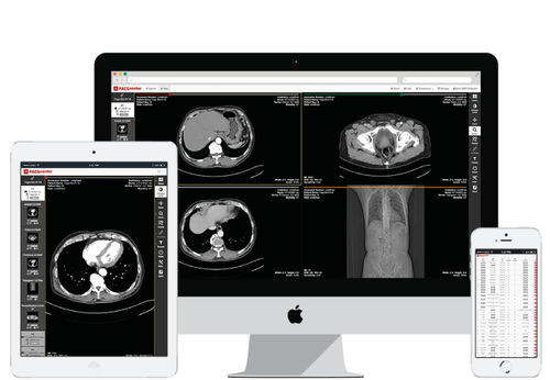 医学成像PACS系统 - PACScenter - BMD Software - 基于网络