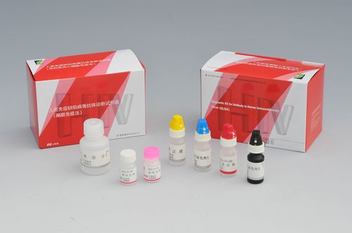 AIDS快速诊断检测 - Shanghai Rongsheng Biotech Co., Ltd. - HIV / ELISA