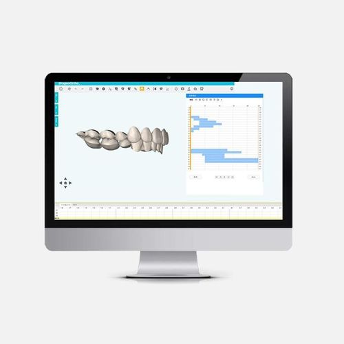 分析软件 - DragonOrtho  - Innovative Material and Devices, Inc. - 规划 / 治疗计划制定 / 加工