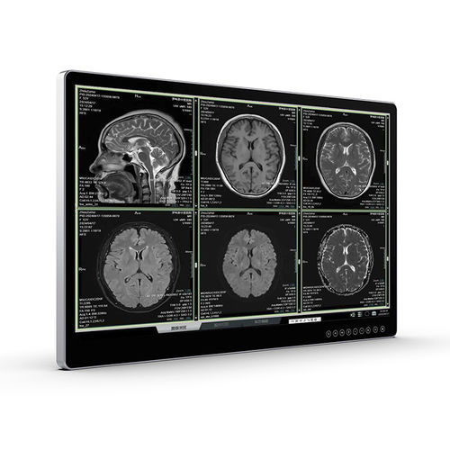 医学成像显示器 - UHD Surgical Monitor - Vecoton Technology - 手术 / 4K分辨率 / 防眩光