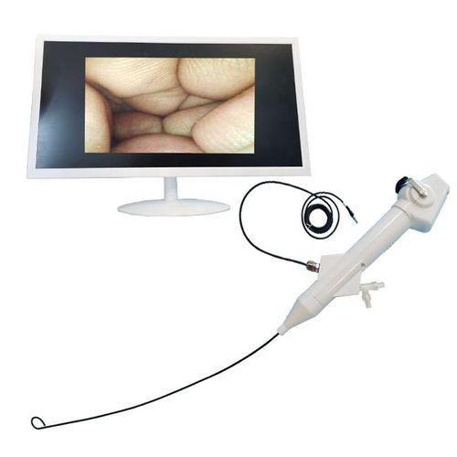 一次性电子输尿管镜 -  Ureter Flexible Nephroscope - Tianjin Guyufan Biological Technology