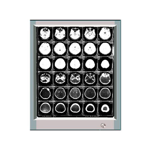 单联式X光片观片灯 - GP1001A - Bellamoon Medical - LED