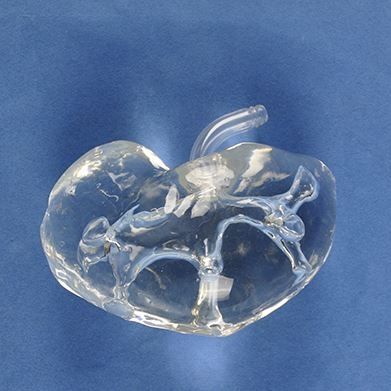 骨盆解剖模型 - Trando 3D Medical Technology - 肾脏 / 输尿管 / 手术