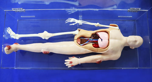 全身解剖模型 - Trando 3D Medical Technology - CT扫描仪 / 可活动