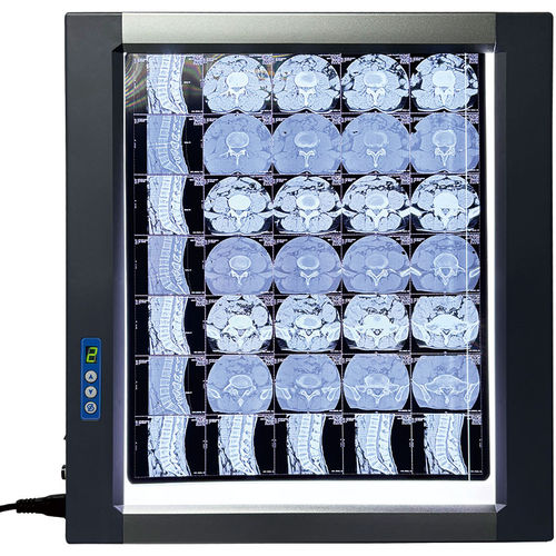 LEDX光片观片灯 - MST-4000I - Shantou Easywell Electronic Technologies - 数字 / 单联式