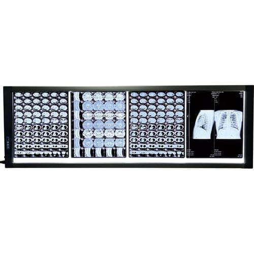 数字X光片观片灯 - MST-4000IV  - Shantou Easywell Electronic Technologies - 4联 / LED
