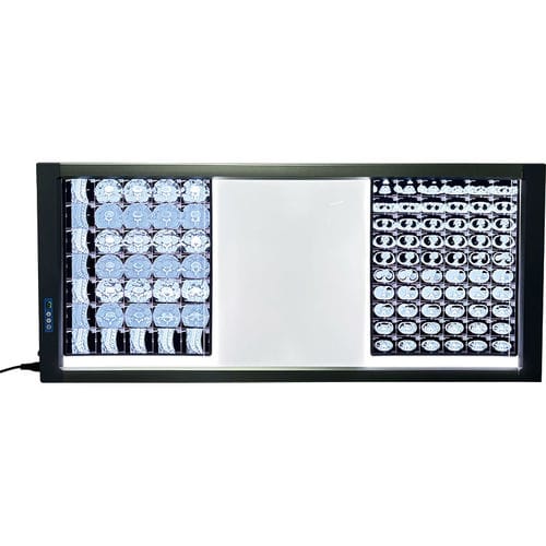 数字X光片观片灯 - MST-4000III - Shantou Easywell Electronic Technologies - 3联 / LED