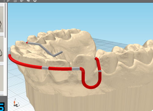 生产软件 - JawDraw® - Advanced Orthodontic Solutions  - 牙科