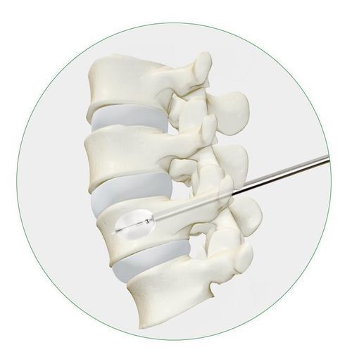 气囊导管椎体强化系统 - Princeton Medical Scientific - 用于经皮椎体后凸成形术