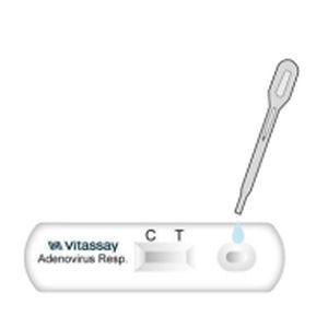 呼吸道疾病快速诊断检测 - VITASSAY HEALTHCARE S.L. - 抗原 / 腺病毒 / 鼻咽