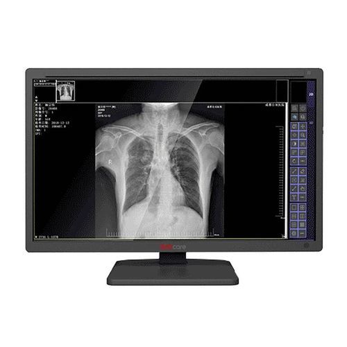 医用显示器 - MDS-C series - Shenzhen Juding Medical Equipment Co.,Ltd. - 诊断 / 医学成像 / 用于放射学