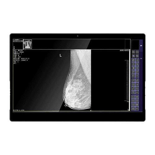 医用显示器 - IVS-8MP - Shenzhen Juding Medical Equipment Co.,Ltd. - 诊断 / 医学成像 / 乳腺造影