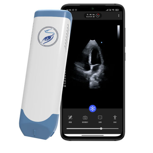手持式B超机 - Lite31P - Beijing iTrason Technologies - 用于心血管超声检查 / 黑白 / 频谱多普勒