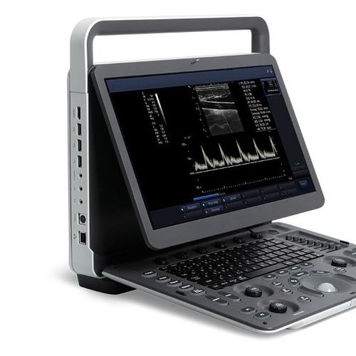 便携式B超机 - E2 - Beijing iTrason Technologies - 用于多功能超声检查 / 妇产科用超声成像 / 腹腔和盆腔超声成像