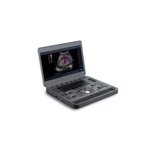 便携式B超机 - X3 - Beijing iTrason Technologies - 用于多功能超声检查 / 妇产科用超声成像 / 腹腔和盆腔超声成像