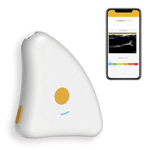 营养人体成分分析仪 - Z2 Pro - Beijing iTrason Technologies - 超声波 / 肥胖症 / 脂肪量测量