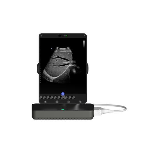 便携式B超机 - Cloud - Beijing iTrason Technologies - 用于多功能超声检查 / 急救超声成像 / 用于胸部超声检查