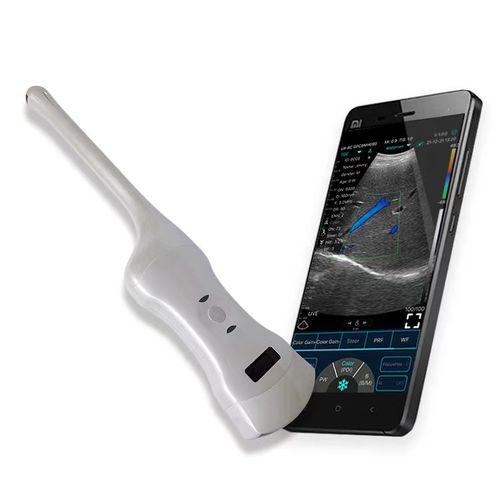 手持式B超机 - C10RT - Beijing iTrason Technologies - 经阴道超声成像 / 经直肠超声成像 / 黑白