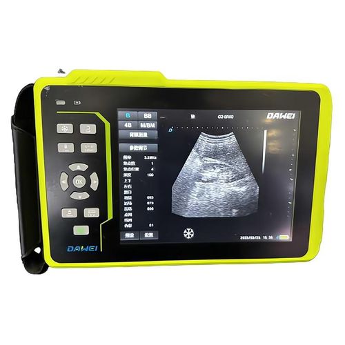 兽医超声波检查仪 / 手持式 - Y6 - Dawei Medical - 多功能 / 小动物 / 大型动物
