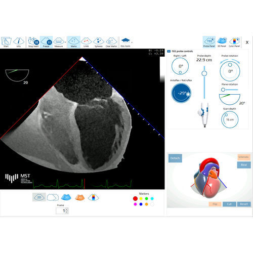 医用软件 - eTEEmothy - Medical Simulation Technologies - 超声波成像 / 超声心动图检查 / 用于心脏病学